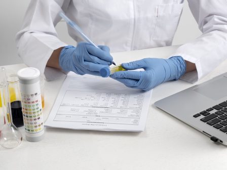 Diagnostika olejů a maziv - Deckenbach CZ